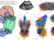 17live
倪东教授团队在《Medical Image Analysis》上发表文章